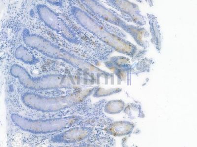 MUC5A Recombinant Rabbit mAb - BF3399 at 1/100 staining human normal colon tissue by IHC-P.