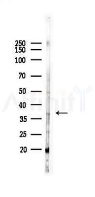 EpCAM Recombinant Rabbit mAb - Western blot analysis of lysates from Rat lung, using EpCAM Recombinant Rabbit mAb at 1/1000 dilution.