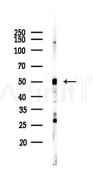 NAMPT Recombinant Rabbit mAb - Western blot analysis of lysates from LoVo cells(heat-shock,45min treatment), using Nampt Recombinant Rabbit mAb at 1/1000 dilution.