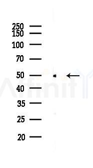 NAMPT Recombinant Rabbit mAb - Western blot analysis of lysates from EC304 cells(LPS, 4h treatment), using Nampt Recombinant Rabbit mAb at 1/1000 dilution.