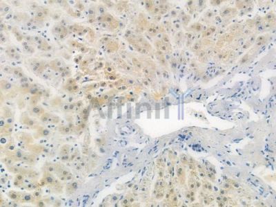 NAMPT Recombinant Rabbit mAb - BF3402 at 1/100 staining human normal liver tissue by IHC-P.