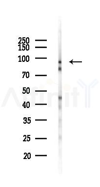 EZH2 Recombinant Rabbit mAb - Western blot analysis of lysates from Rat spleen, using EZH2 Recombinant Rabbit mAb at 1/1000 dilution.