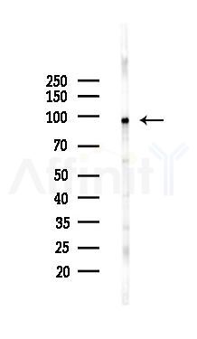 EZH2 Recombinant Rabbit mAb - Western blot analysis of lysates from HUVEC cells(LPS,4h treatment), using EZH2 Recombinant Rabbit mAb at 1/1000 dilution.
