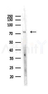 Angiopoietin 1 Recombinant Rabbit mAb - Western blot analysis of lysates from Hela cells(LPS,4h treatment), using Angiopoietin 1 Recombinant Rabbit mAb at 1/1000 dilution.