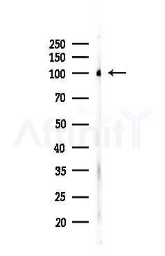 AR Recombinant Rabbit mAb - Western blot analysis of lysates from Hela cells(heat-shock,45min treatment), using Androgen Receptor Recombinant Rabbit mAb at 1/1000 dilution.