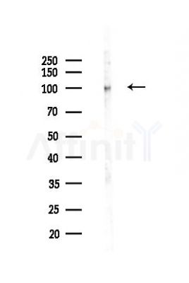 IGF1 Receptor Recombinant Rabbit mAb - Western blot analysis of lysates from Mouse liver, using IGF-I receptor beta Recombinant Rabbit mAb at 1/1000 dilution.