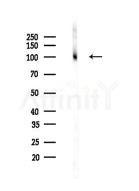 IGF1 Receptor Recombinant Rabbit mAb - Western blot analysis of lysates from Rat heart, using IGF-I receptor beta Recombinant Rabbit mAb at 1/1000 dilution.