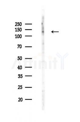 IGF1 Receptor Recombinant Rabbit mAb - Western blot analysis of lysates from Hela cells(LPS,4h treatment), using IGF-I receptor beta Recombinant Rabbit mAb at 1/1000 dilution.