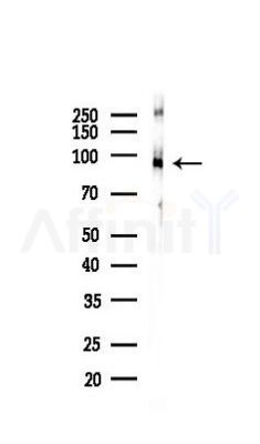 Phospho-IGF1R(Tyr1166)/Insulin Receptor(Tyr1190) Recombinant Rabbit mAb - Western blot analysis of lysates from Mouse liver, using Phospho-IGF-I receptor beta (Tyr1166) Recombinant Rabbit mAb at 1/1000 dilution.