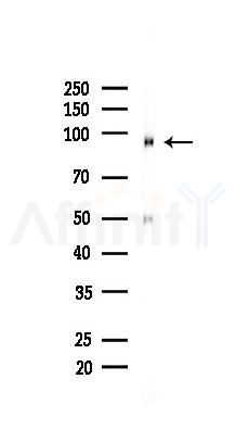 Phospho-IGF1R(Tyr1166)/Insulin Receptor(Tyr1190) Recombinant Rabbit mAb - Western blot analysis of lysates from HUVEC cells(LPS,4h treatment), using Phospho-IGF-I receptor beta (Tyr1166) Recombinant Rabbit mAb at 1/1000 dilution.