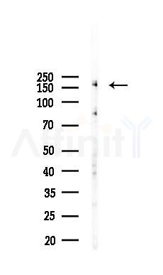 c-Met Recombinant Rabbit mAb - Western blot analysis of lysates from Hela cells(LPS, 4h treatment), using c-Met Recombinant Rabbit mAb at 1/1000 dilution.