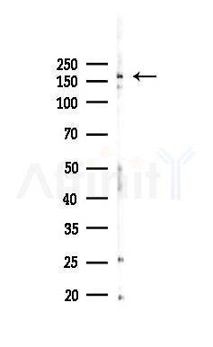 c-Met Recombinant Rabbit mAb - Western blot analysis of lysates from Hela cells(heat-shock,45min treatment), using c-Met Recombinant Rabbit mAb at 1/1000 dilution.