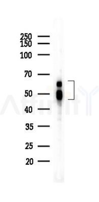 WT1 Recombinant Rabbit mAb - Western blot analysis of lysates from HUVEC cells(heat-shock 45min treatment), using WT1 Recombinant Rabbit mAb at 1/1000 dilution.