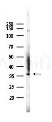 IL12A Recombinant Rabbit mAb - Western blot analysis of lysates from B16F10-LUC cells(LPS,4h treatment), using IL-12A Rabbit mAb at 1/1000 dilution.