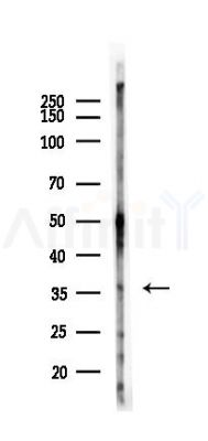 IL12A Recombinant Rabbit mAb - Western blot analysis of lysates from Rat testis, using IL-12A Rabbit mAb at 1/1000 dilution.
