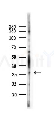 IL12A Recombinant Rabbit mAb - Western blot analysis of lysates from HepG2 cells(heat-shock,45min treatment), using IL-12A Rabbit mAb at 1/1000 dilution.