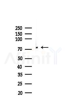 GCLC Recombinant Rabbit mAb - Western blot analysis of lysates from HUVEC cells(LPS,4h treatment), using GCLC Recombinant Rabbit mAb at 1/1000 dilution.