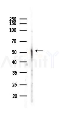 Angiopoietin 2 Recombinant Rabbit mAb - Western blot analysis of lysates from Hela cells(LPS,4h treatment), using Angiopoietin 2 Recombinant Rabbit mAb at 1/1000 dilution.