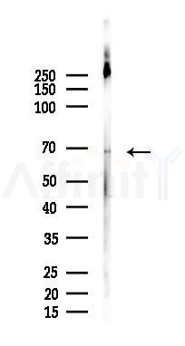 Involucrin Recombinant Rabbit mAb - Western blot analysis of lysates from Rat brain, using Involucrin Recombinant Rabbit mAb at 1/1000 dilution.