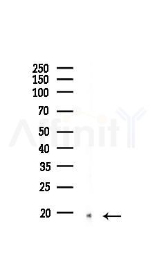 Survivin Recombinant Rabbit mAb - Western blot analysis of lysates from COLO205 cells(LPS, 4h treatment), using Survivin Recombinant Rabbit mAb at 1/1000 dilution.