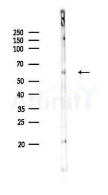 VGluT1 Recombinant Rabbit mAb - Western blot analysis of lysates from Rat testis, using VGLUT1 Recombinant Rabbit mAb at 1/1000 dilution.