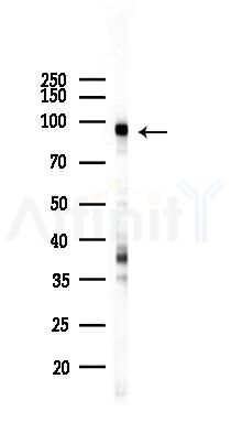DNMT3A Recombinant Rabbit mAb - Western blot analysis of lysates from Hela cells(LPS,4h treatment), using Dnmt3a Recombinant Rabbit mAb at 1/1000 dilution.