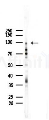 DNMT3A Recombinant Rabbit mAb - Western blot analysis of lysates from Mouse testis, using Dnmt3a Recombinant Rabbit mAb at 1/1000 dilution.