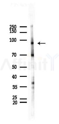 DNMT3A Recombinant Rabbit mAb - Western blot analysis of lysates from Rat testis, using Dnmt3a Recombinant Rabbit mAb at 1/1000 dilution.