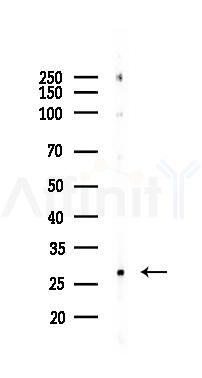 Galectin-9 Recombinant Rabbit mAb - Western blot analysis of lysates from RAW264.