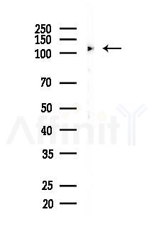 STAT2 Recombinant Rabbit mAb - Western blot analysis of lysates from COLO205 cells(heat-shock, 45min treatment), using STAT2 Recombinant Rabbit mAb at 1/1000 dilution.