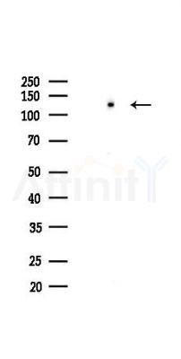 NF kappaB p100/p52 Recombinant Rabbit mAb - Western blot analysis of lysates from HepG2 cells(heat-shock,45min treatment), using NFKB p100 Recombinant Rabbit mAb at 1/1000 dilution.