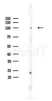 NF kappaB p100/p52 Recombinant Rabbit mAb - Western blot analysis of lysates from Rat lung, using NFKB p100 Recombinant Rabbit mAb at 1/1000 dilution.