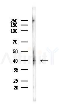 Cytokeratin 18 Recombinant Rabbit mAb - Western blot analysis of lysates from HUVEC cells(starvation 24h treatment), using Cytokeratin 18 Recombinant Rabbit mAb at 1/1000 dilution.