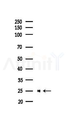 PGP9.5 Recombinant Rabbit mAb - Western blot analysis of lysates from HUVEC cells(LPS,4h treatment), using PGP9.
