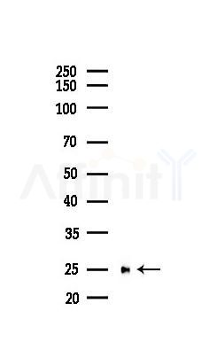 PGP9.5 Recombinant Rabbit mAb - Western blot analysis of lysates from B16F10-LUC cells(LPS,4h treatment), using PGP9.