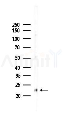 p27 Kip1 Recombinant Rabbit mAb - Western blot analysis of lysates from B16F10-LUC cells(heat-shock,45min treatment), using p27 KIP 1 Recombinant Rabbit mAb at 1/1000 dilution.