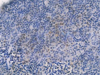 p27 Kip1 Recombinant Rabbit mAb - BF3436 at 1/100 staining human normal tonsil tissue by IHC-P.