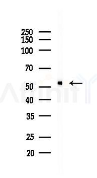 GLUT3 Recombinant Rabbit mAb - Western blot analysis of lysates from Rat brain, using Glucose Transporter GLUT3 Recombinant Rabbit mAb at 1/1000 dilution.