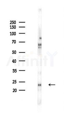 BAD Recombinant Rabbit mAb - Western blot analysis of lysates from COLO205 cells(LPS,4h treatment), using Bad Recombinant Rabbit mAb at 1/1000 dilution.