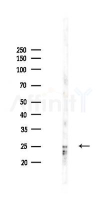 BAD Recombinant Rabbit mAb - Western blot analysis of lysates from Mouse brain, using Bad Recombinant Rabbit mAb at 1/1000 dilution.