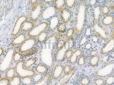 BAD Recombinant Rabbit mAb - BF3439 at 1/100 staining human normal kidney tissue by IHC-P.