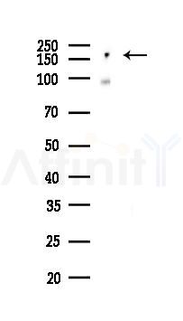 HER2/ErbB2 Recombinant Rabbit mAb - Western blot analysis of lysates from Mouse liver, using ErbB 2 Recombinant Rabbit mAb at 1/1000 dilution.