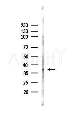 RAD51 Recombinant Rabbit mAb - Western blot analysis of lysates from HUVEC cells(LPS,4h treatment), using Rad51 Recombinant Rabbit mAb at 1/1000 dilution.