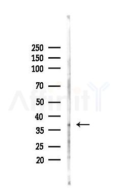 RAD51 Recombinant Rabbit mAb - Western blot analysis of lysates from COLO205 cells(heat-shock,45min treatment), using Rad51 Recombinant Rabbit mAb at 1/1000 dilution.