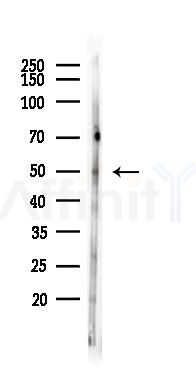 Phospho-PTEN (Ser380) Recombinant Rabbit mAb - Western blot analysis of lysates from Rat lung, using Phospho-PTEN (Ser380) Recombinant Rabbit mAb at 1/1000 dilution.