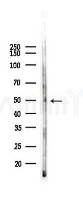 Phospho-PTEN (Ser380) Recombinant Rabbit mAb - Western blot analysis of lysates from A2780 cells(LPS 4h treatment), using Phospho-PTEN (Ser380) Recombinant Rabbit mAb at 1/1000 dilution.