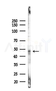 Cyclin E1 Recombinant Rabbit mAb - Western blot analysis of lysates from EC304 cells(heat-shock,45min treatment), using Cyclin E1 Recombinant Rabbit mAb at 1/1000 dilution.