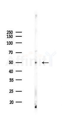 TNF Receptor I Recombinant Rabbit mAb - Western blot analysis of lysates from Mouse testis, using TNF Receptor I Recombinant Rabbit mAb at 1/1000 dilution.