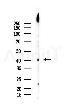 AGTR1 Recombinant Rabbit mAb - Western blot analysis of lysates from Rat muscle, using Angiotensin II Type 1 Receptor Recombinant Rabbit mAb at 1/1000 dilution.