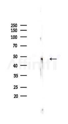 NRF1 Recombinant Rabbit mAb - Western blot analysis of lysates from HepG2 cells(heat-shock,45min treatment), using Nrf1 Recombinant Rabbit mAb at 1/1000 dilution.